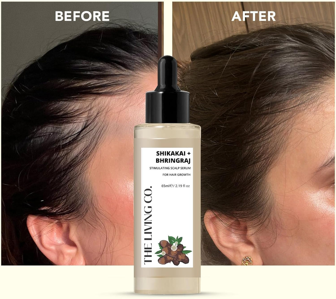 THE LIVING CO. Shikakai + Bhringraj Stimulating Scalp Serum For Hair Growth - 65ml